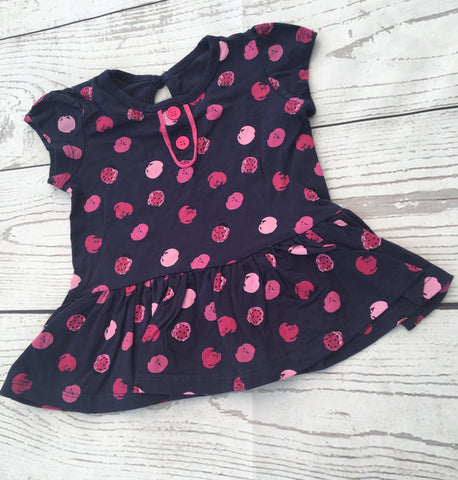 3-6 Months Tunic Top Unworn